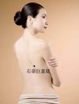 女人身上的8種福痣5種禍痣